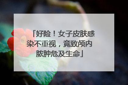好险！女子皮肤感染不重视，竟致颅内脓肿危及生命